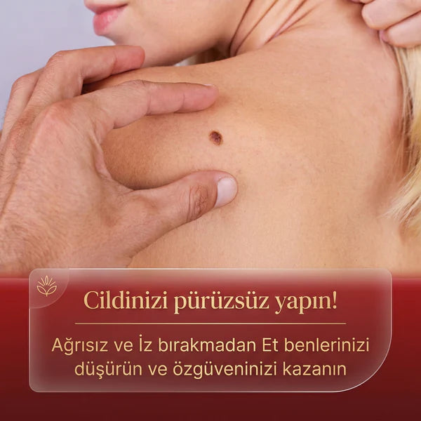 Neatify Benstop Mikro İğneli Ben Ve Siğil Düşürücü Bant – 5 Günde İz Bırakmadan Düşürür